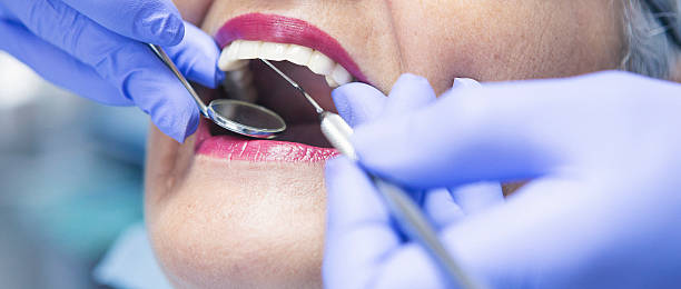 Best Emergency Dentist for Knocked-Out Tooth in Choccolocco, AL